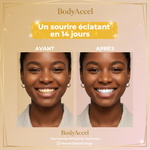 Charger l'image dans la galerie, BodyAccel