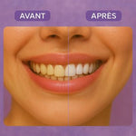 Charger l'image dans la galerie, Smilekit Blanchisseur de Dent