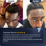 Charger l'image dans la galerie, Repousse Cheveux
